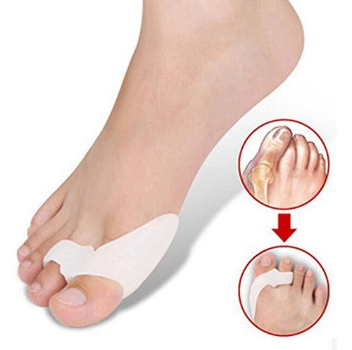Corrector De Juanetes Ortopedico Gel Silicona Par Premium